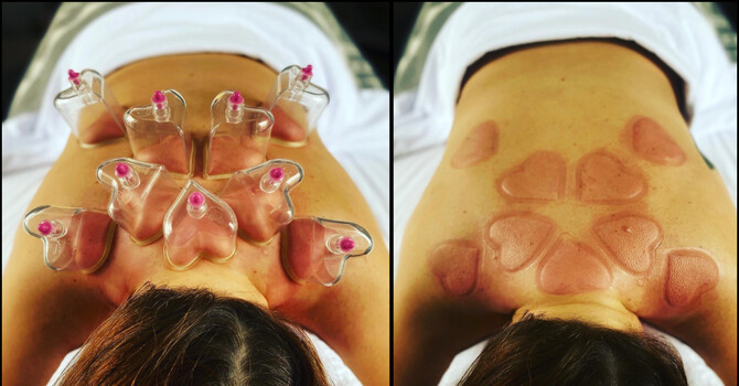 Cups that Care image